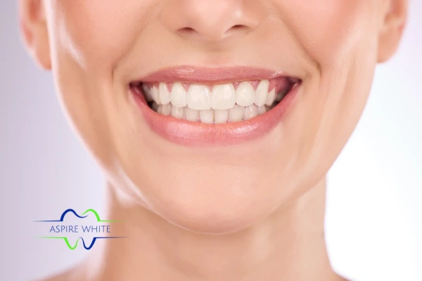 Follow your teeth whitening aftercare Milton Keynes to prolong your whiter smile!