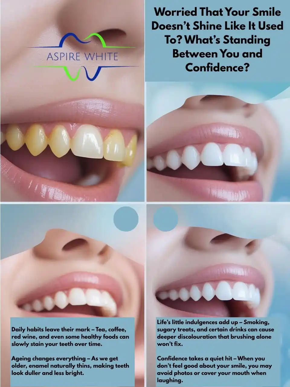 Worried That Your Smile Doesn’t Shine Like It Used To What’s Standing Between You and Confidence Milton Keynes